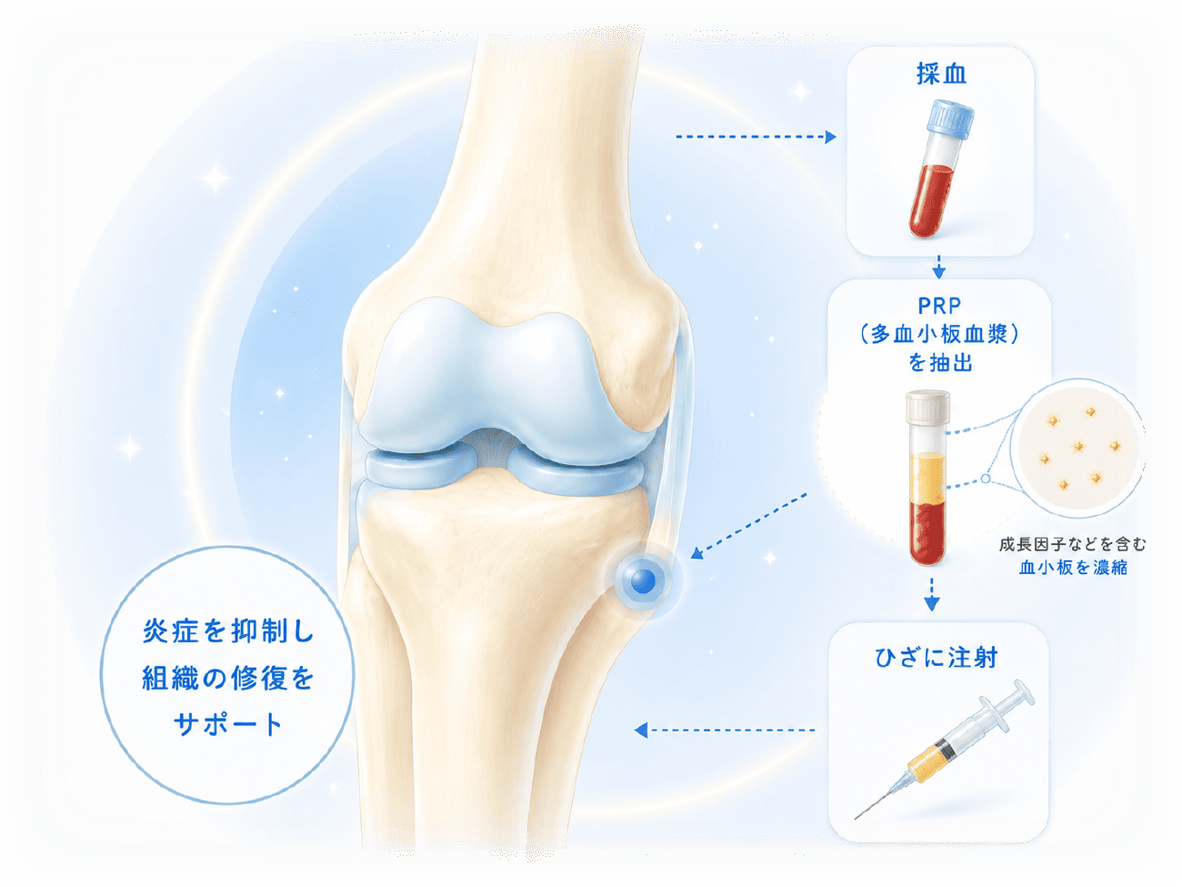 ご自身の血液の力を活かし、ひざの痛みにアプローチ